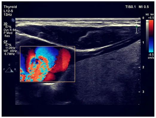 Zdjęcie USG kolor 1