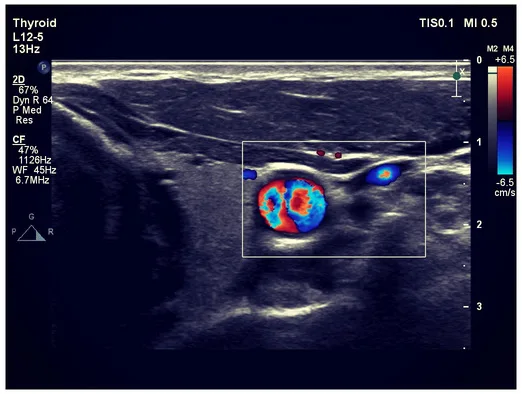 Zdjęcie USG kolor 2
