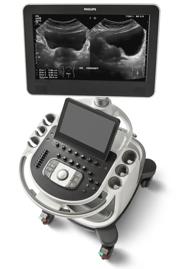 Aparat USG Philips AFFINITI 50G